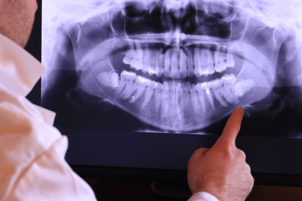 Best Emergency Treatment for Jaw Pain or Injury in Nuevo, CA